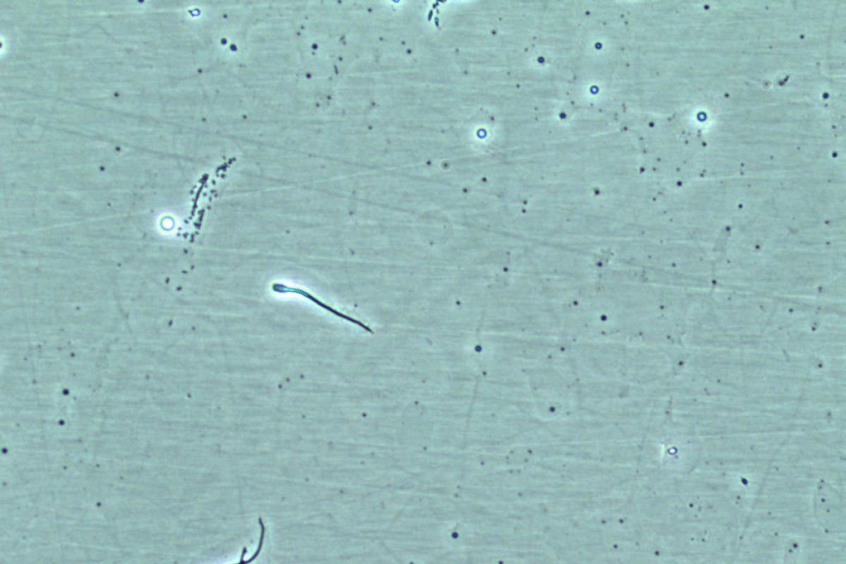 Human sperm cells imaged by the BSMP on ISS