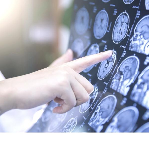 fmri