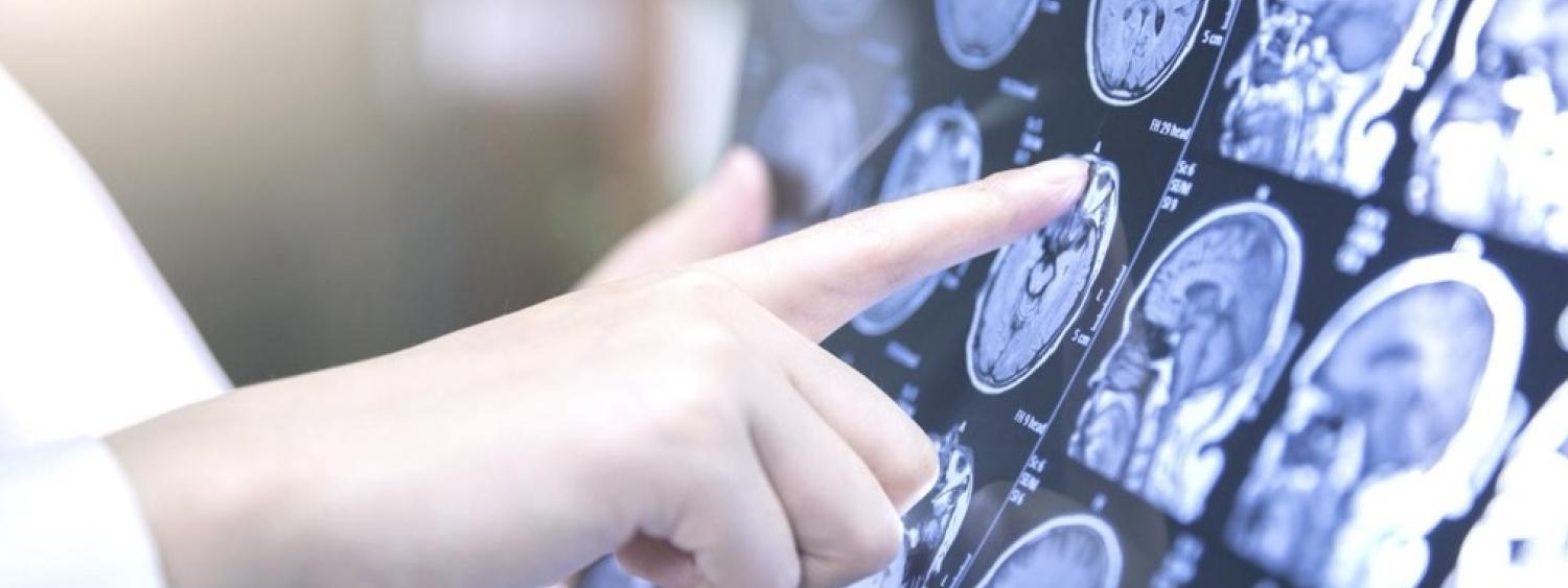 finger pointing to fmri