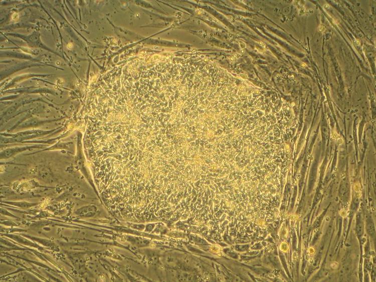 Human stem cell iPSC colony.