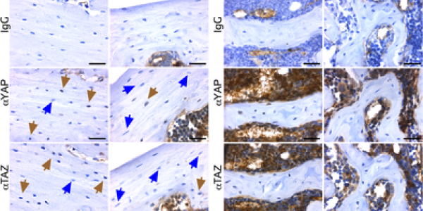 8 kb‐DMP1‐Cre selectively ablated YAP/TAZ expression from osteocytes