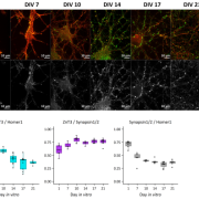 Expression and localization of Zn2+ transporter ZnT3 in cultured neurons by immunofuorescence. 