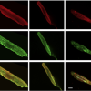 images of adult mouse cardiomyocytes