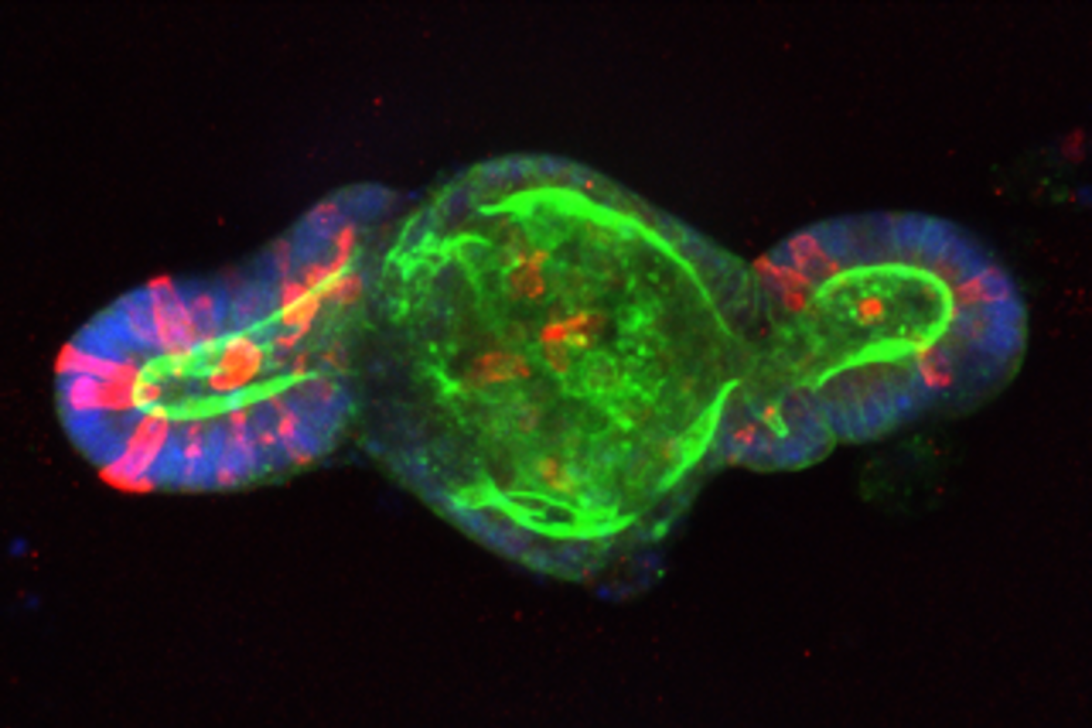 Biomaterial matrices engineered to direct stem cells into growing intestinal organoids