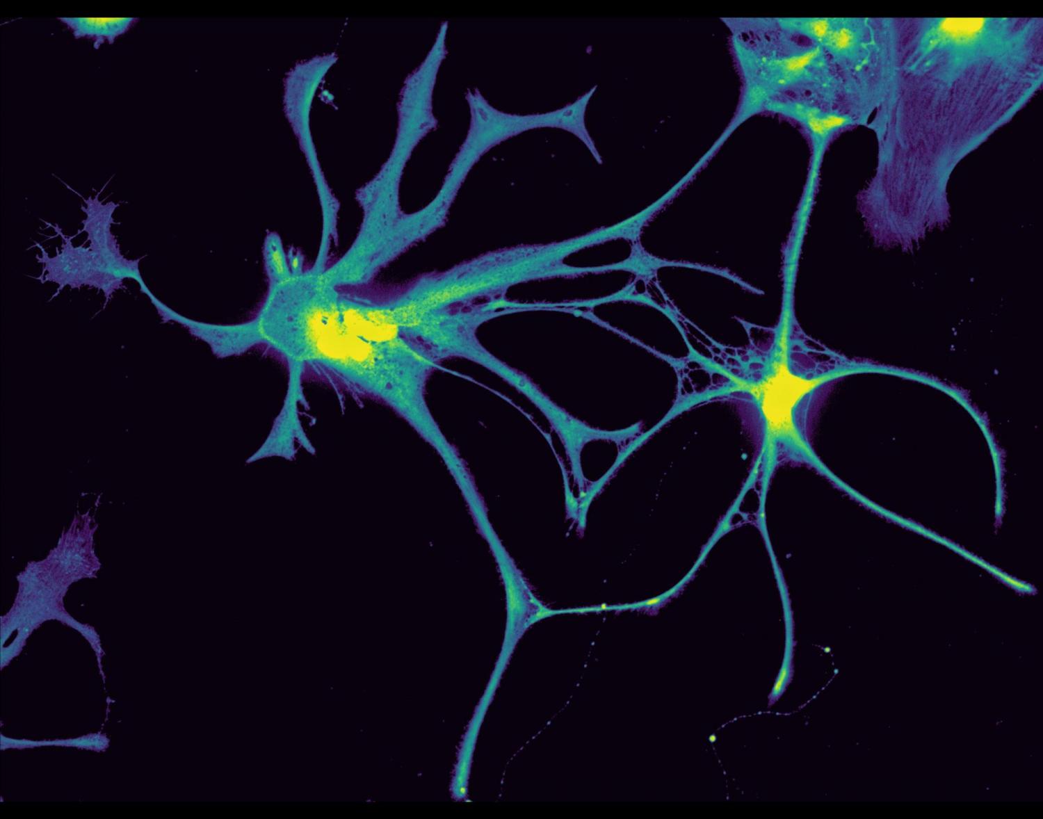 Glial cells 