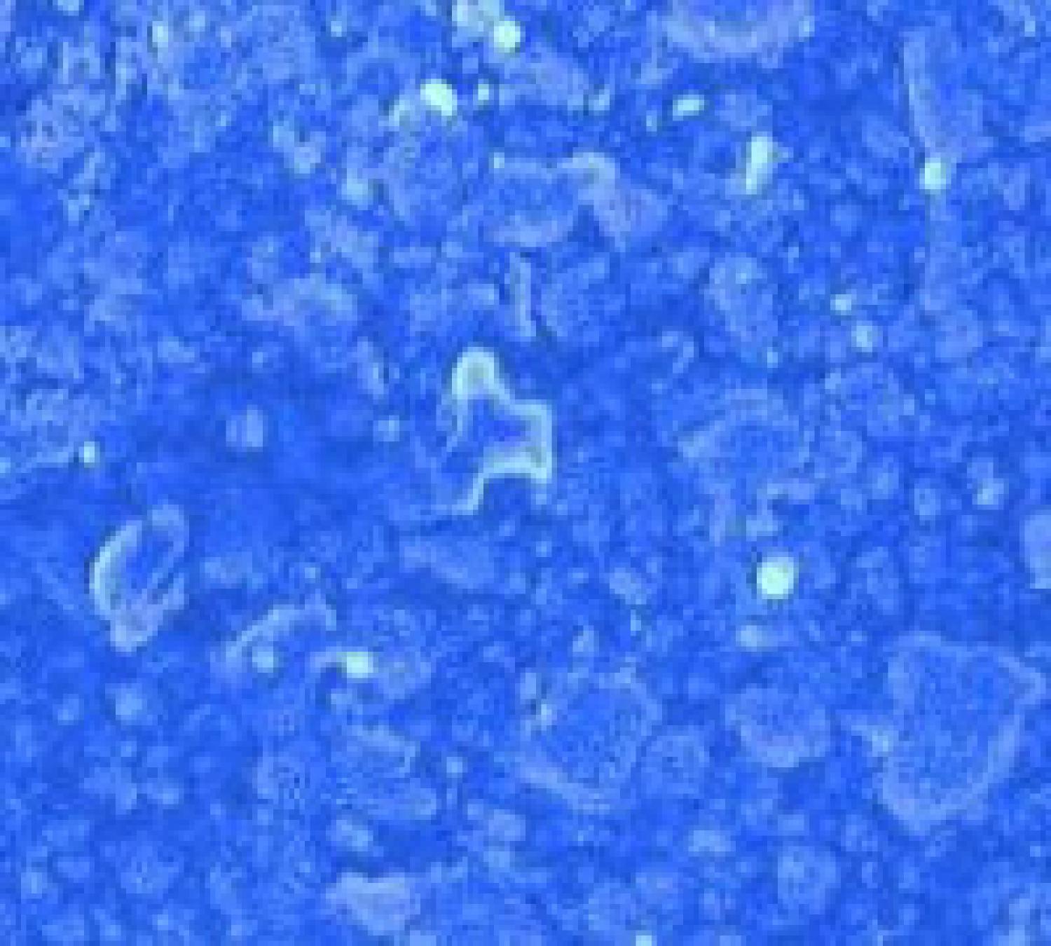 Scanning electron micrograph of generic composite structure showing 70% filler.