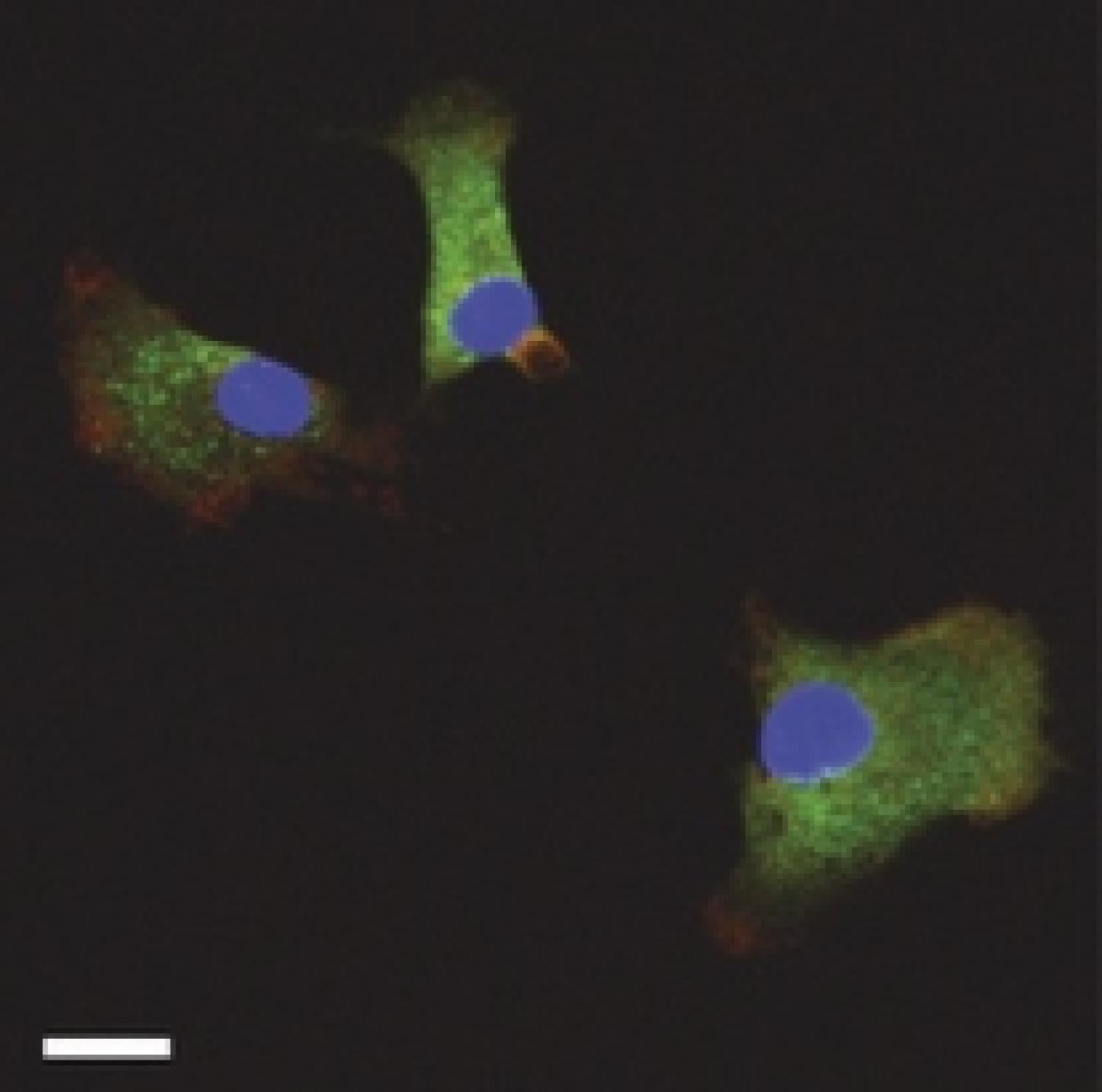 Picture from Anseth's Nature article
