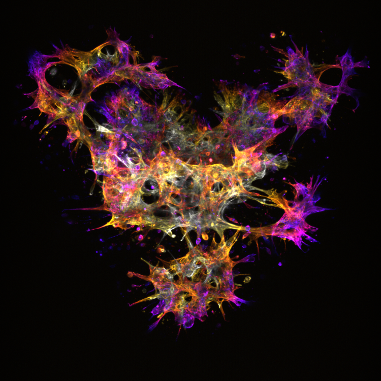 Fluorescent microscopy image showing a cluster of irregular, web-like cell structures in vivid colors&mdash;yellow, orange, pink, purple, and white&mdash;against a black background. The cells have spiky, branching projections and multiple circular openings, creating a complex, textured network.