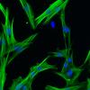 chromatin remodelling in persistently activated fibroblasts
