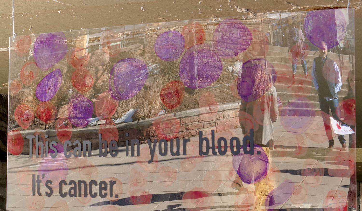 Andrus and the Through It team created an art installation to raise awareness about lymphoma as part of their project for the Bateman Case Study Competition.