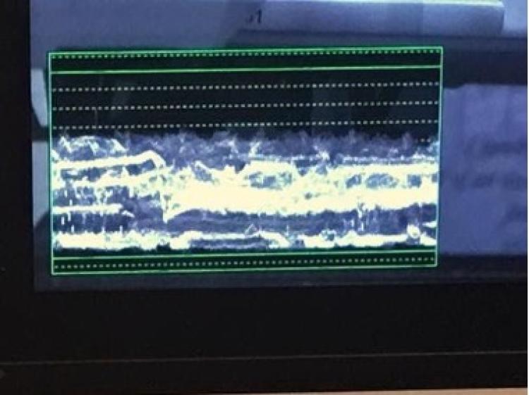 Close-up waveform monitor example