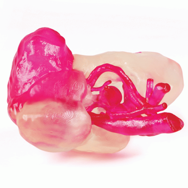 3D kidney