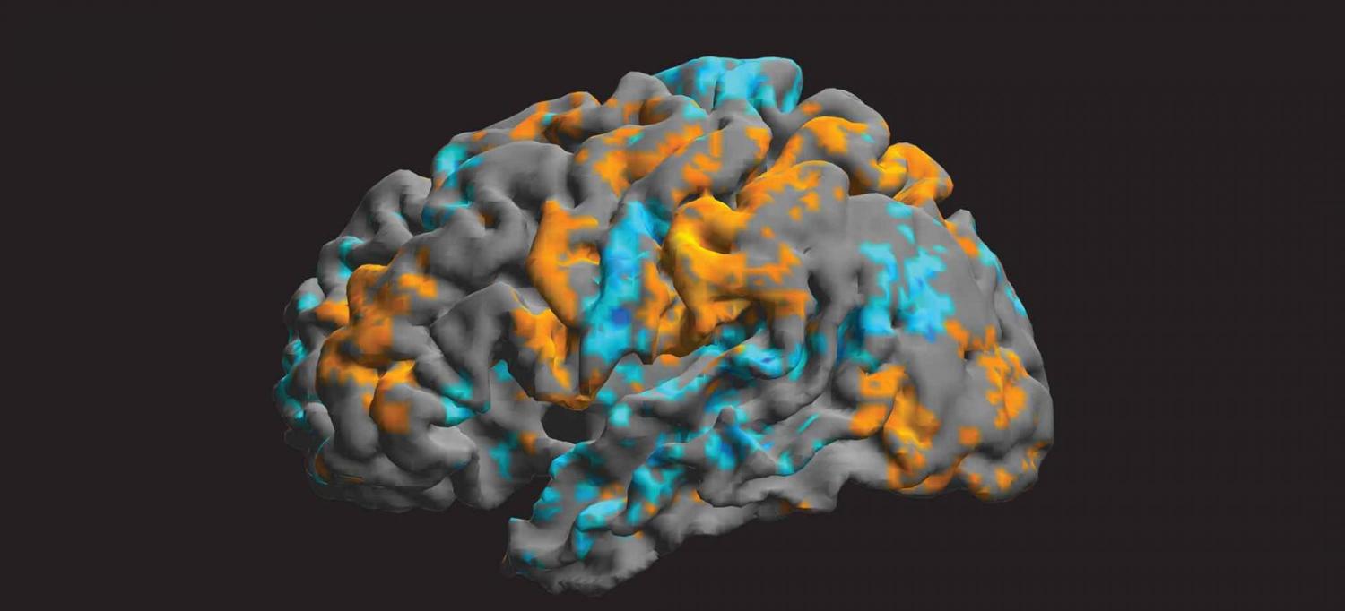 brain image