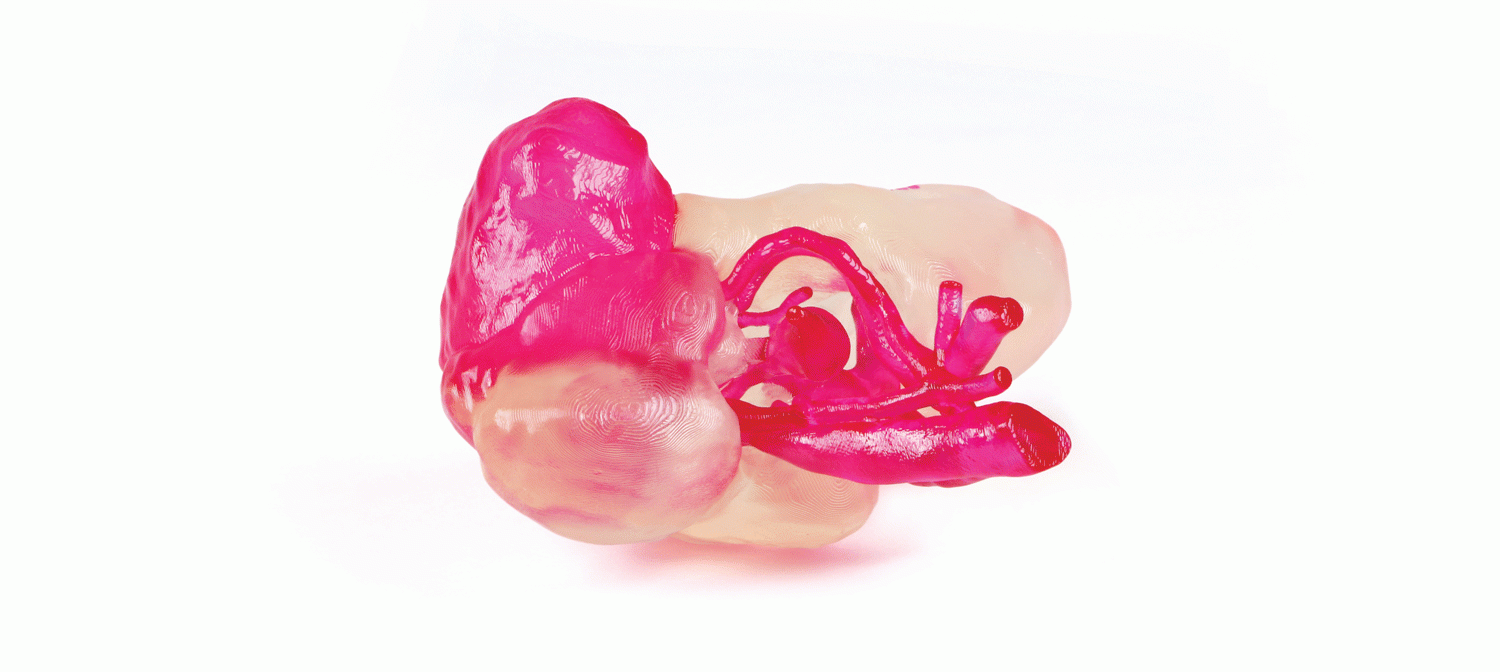 3D kidney