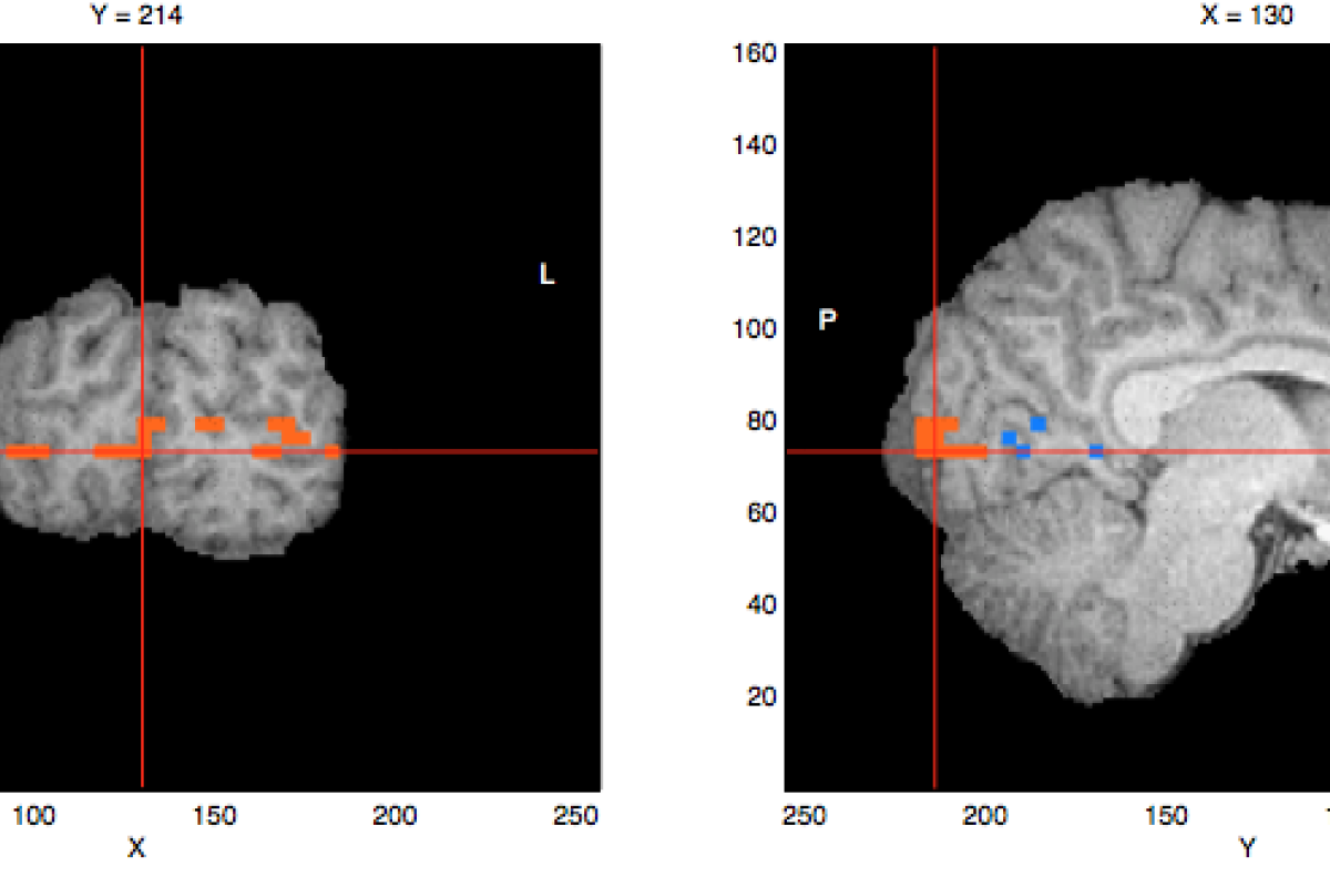 A set of brain scans