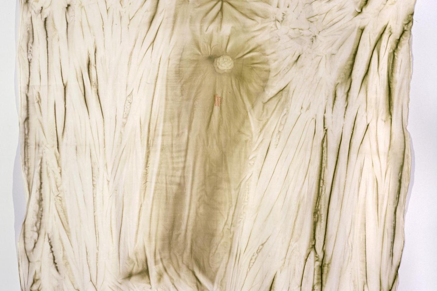 Hospital bedsheet with stains