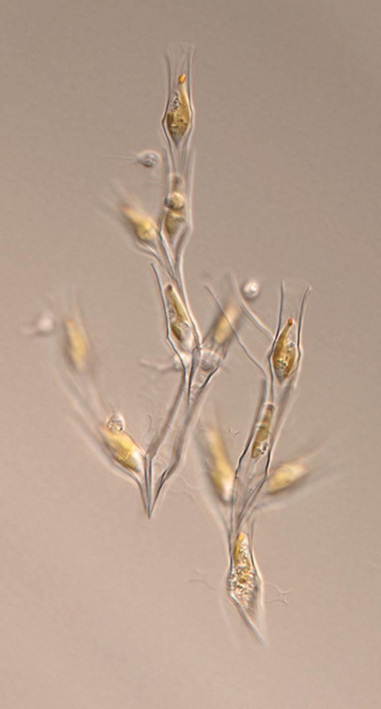 diatom