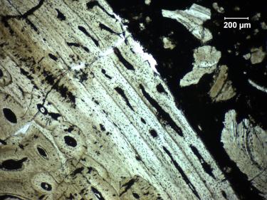 Bone fragmant as seen through a microscope.