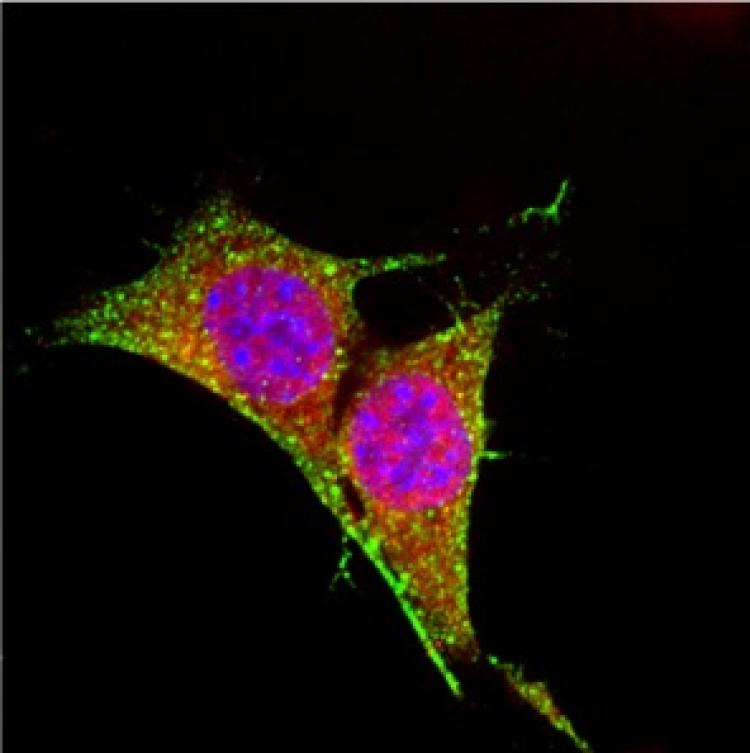 Microscopy image showing uptake of fluorescently labeled polymers