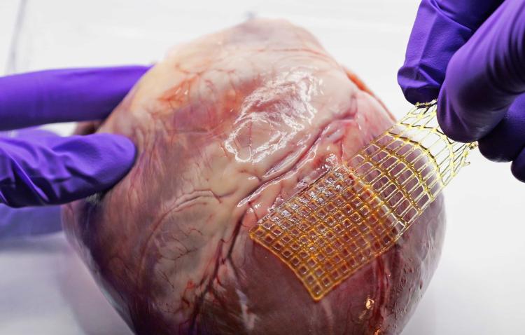 3D printed bio-mesh