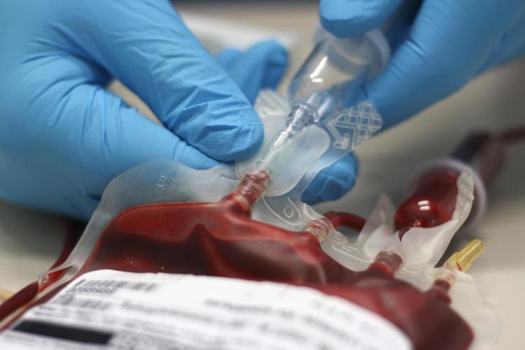 Blood bag being prepped for transfusion