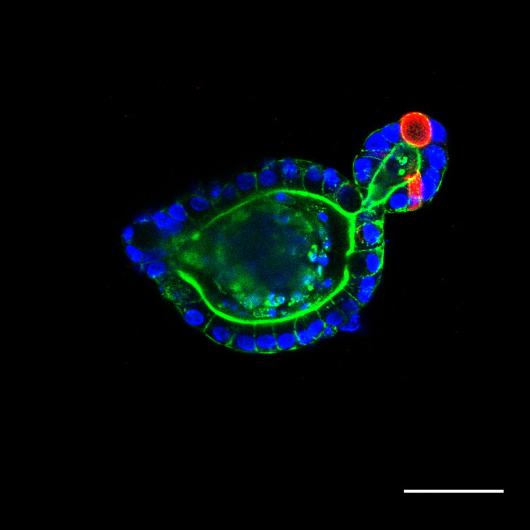 An intestinal organoid