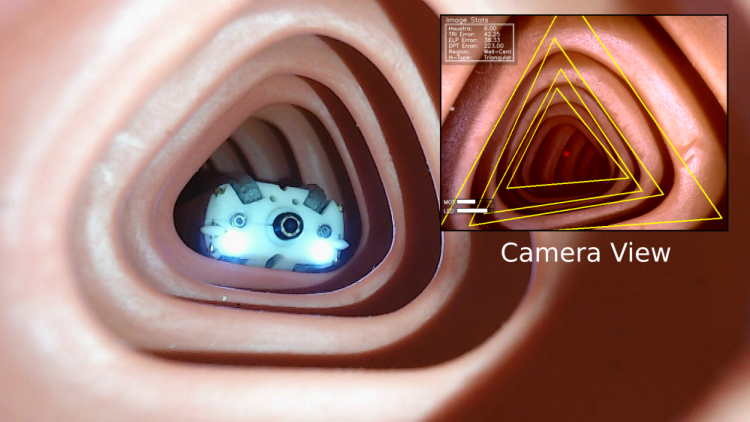 A robot making its way through the colon