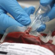 A blood bag being prepped for transfusion 