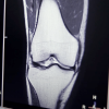 X-ray image of knee joints