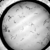 Worms in a dish swimming around
