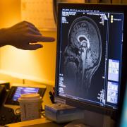 Researcher points to MRI results on computer screen