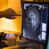 Researcher points to MRI results on computer screen