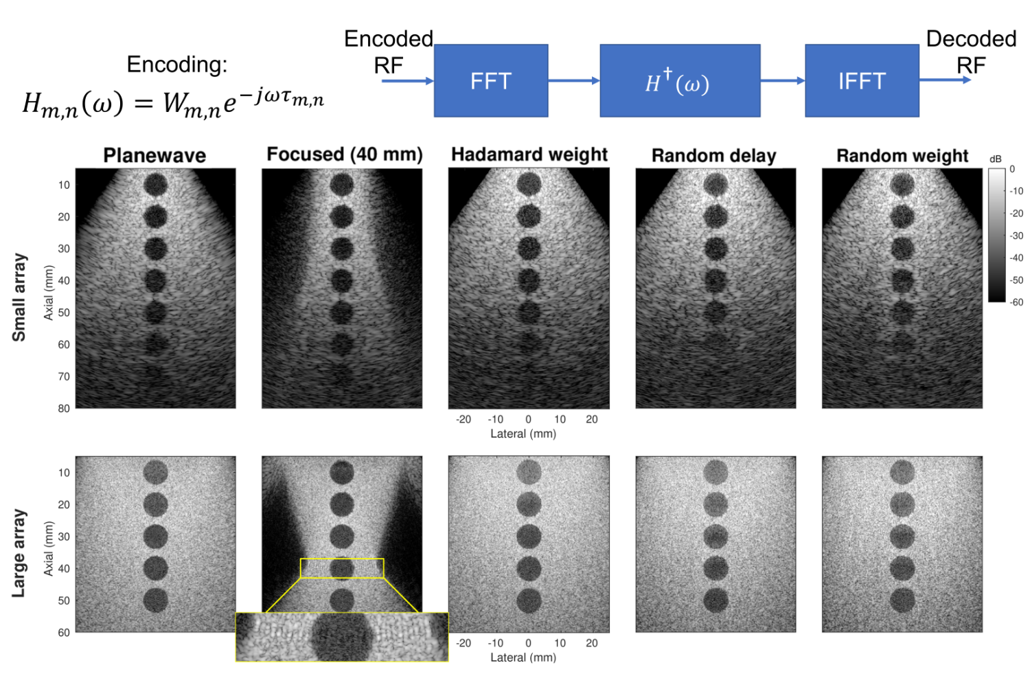 REFoCUS approach to beamforming