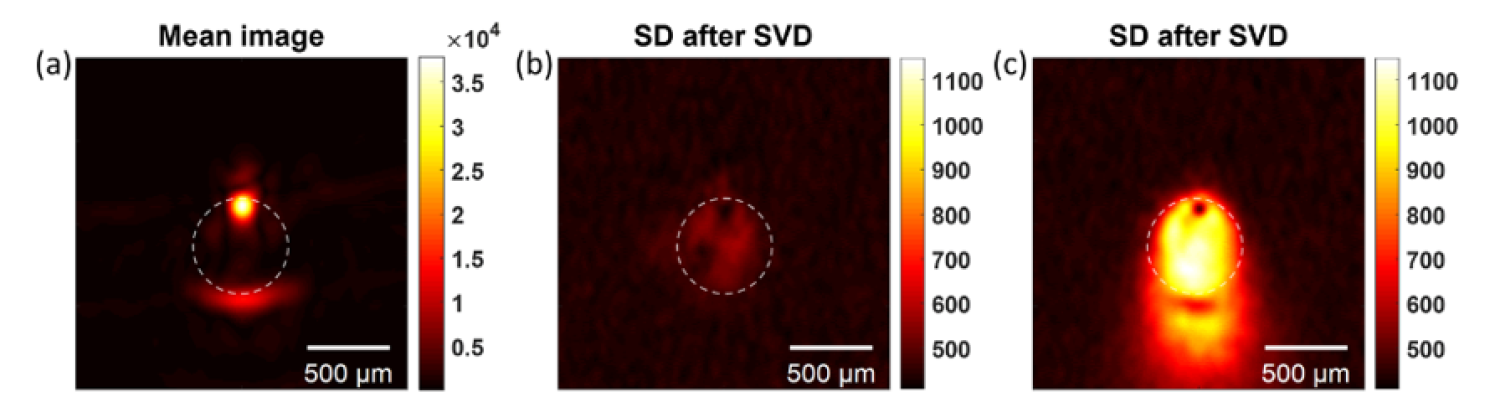 Microbubble fluctuation imaging