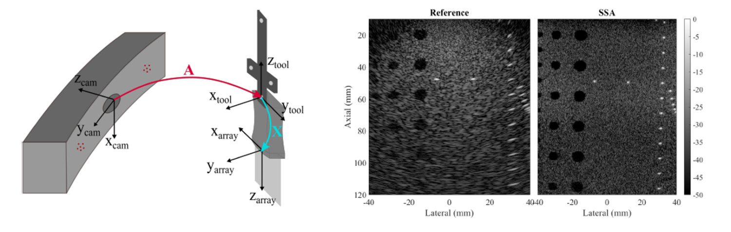 Optically tracked SSA