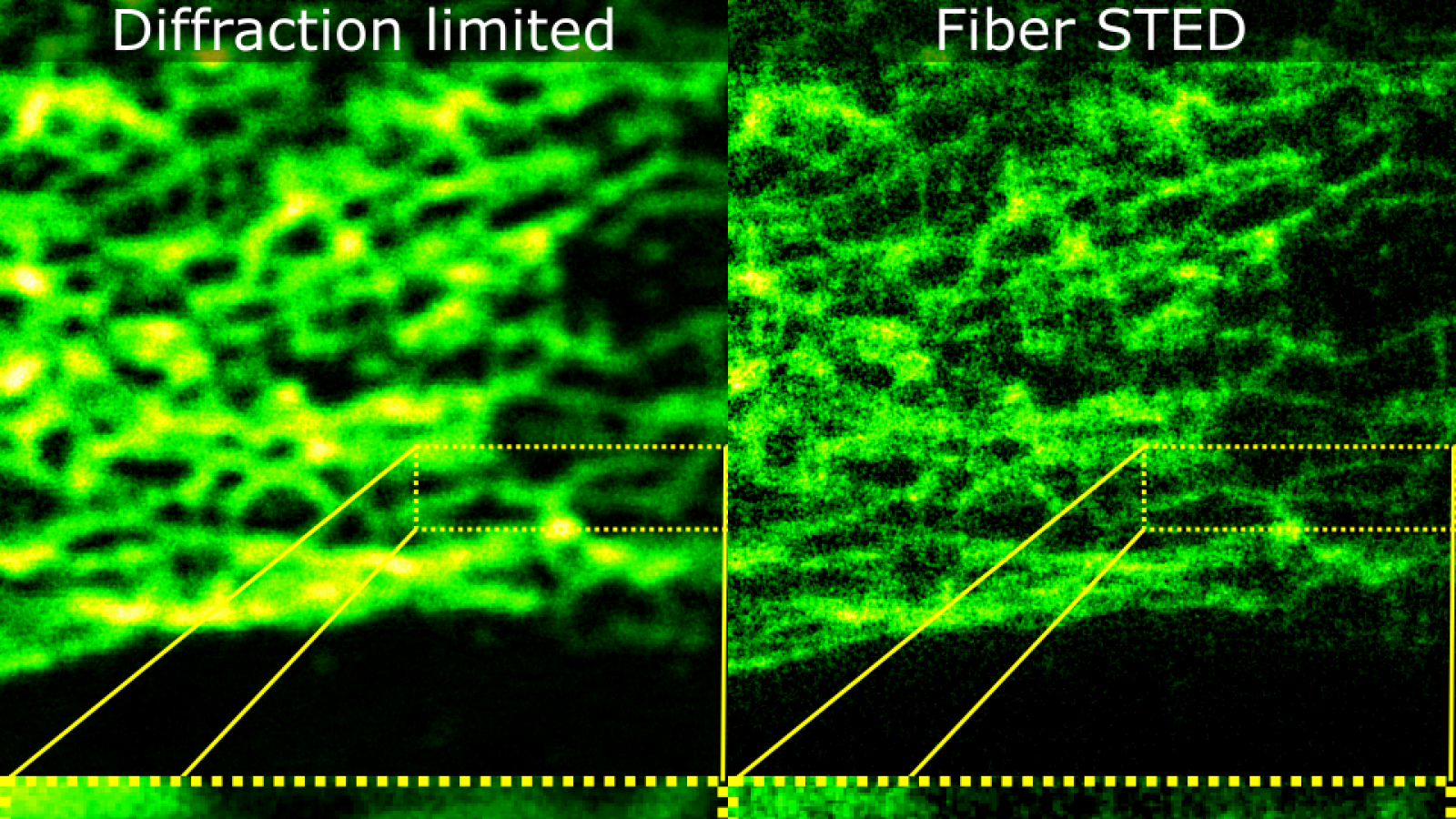 An image showing the difference between diffraction limited and fiber STED imaging.