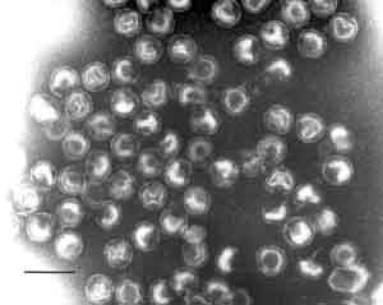 image of bacteriophage PRD1