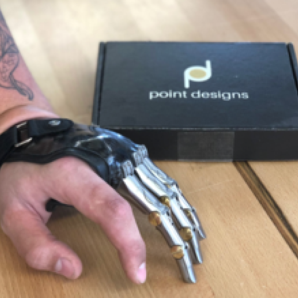 Partial prosthetic hand on someone. Their thumb and pointer finger are visible, and the other three fingers are robotic.