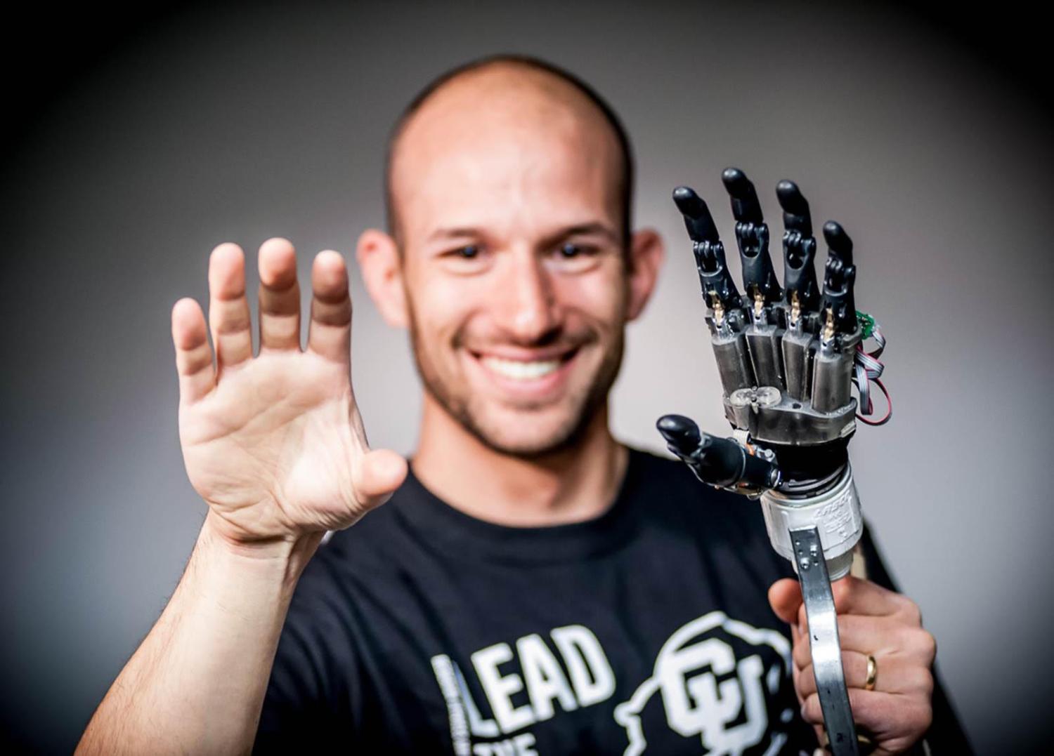 A man with his hands in front of him. His left hand is prosthetic.