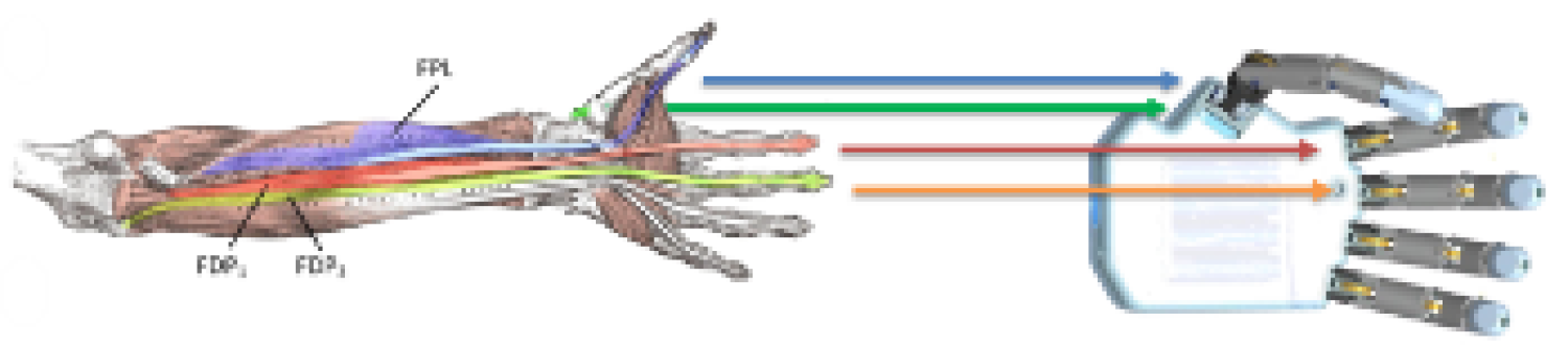 Diagram showing where the prosthetic hands connect to nerves.