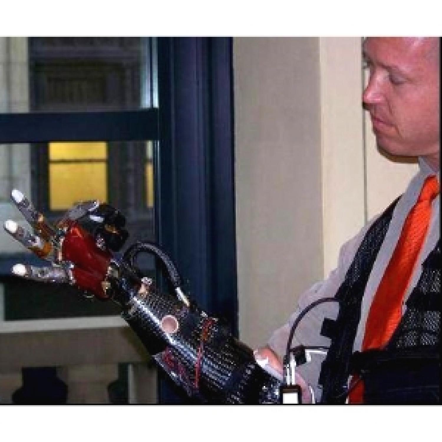 Man wearing a DARPA prosthetic hand prototype