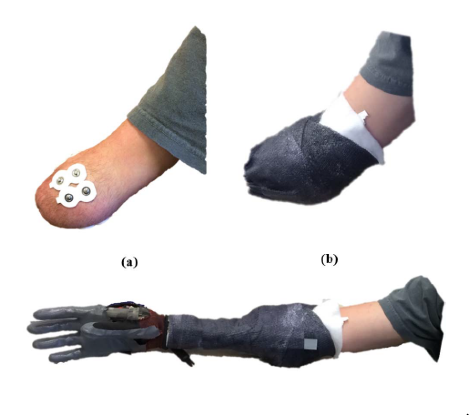 Three images demonstrating the attachment of the prosthetic arm.
