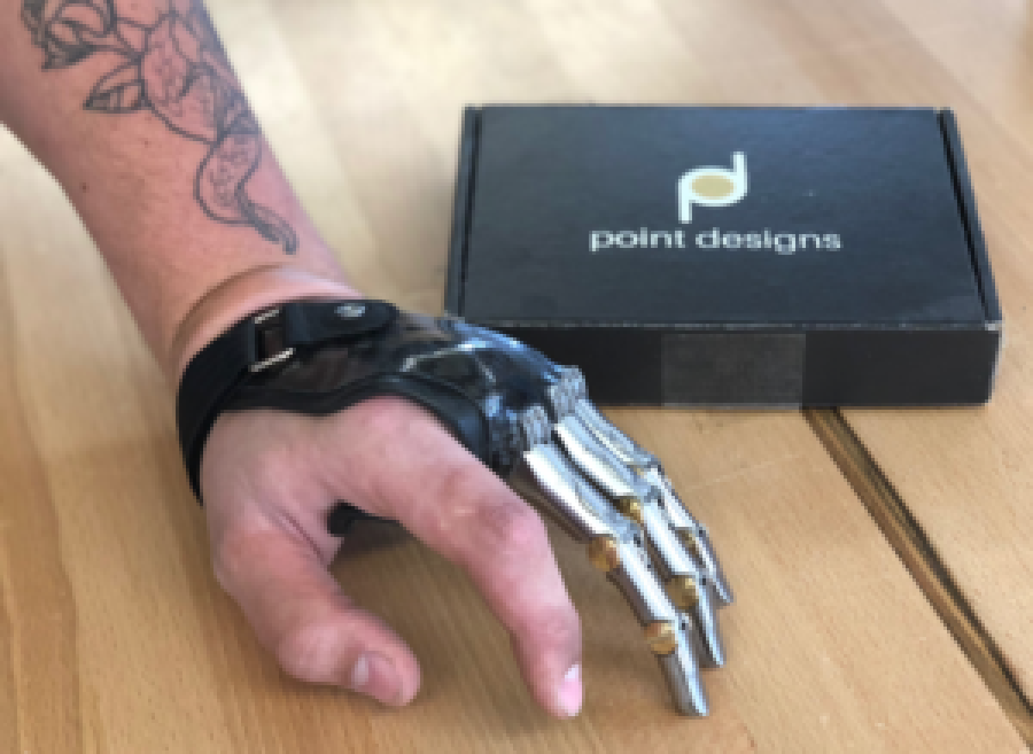 A hand fitted with a partial prosthetic hand. The pointer and thumb are not robotic. The other three are.