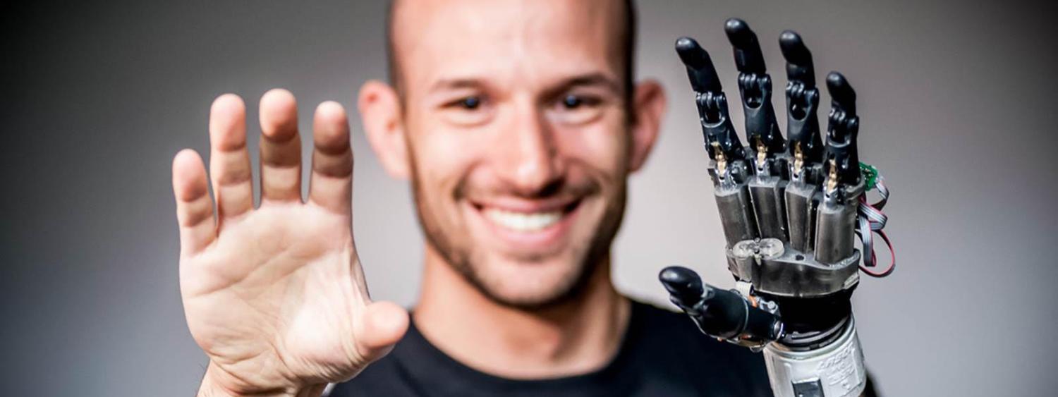 A man with his hands in front of him. His left hand is prosthetic. 