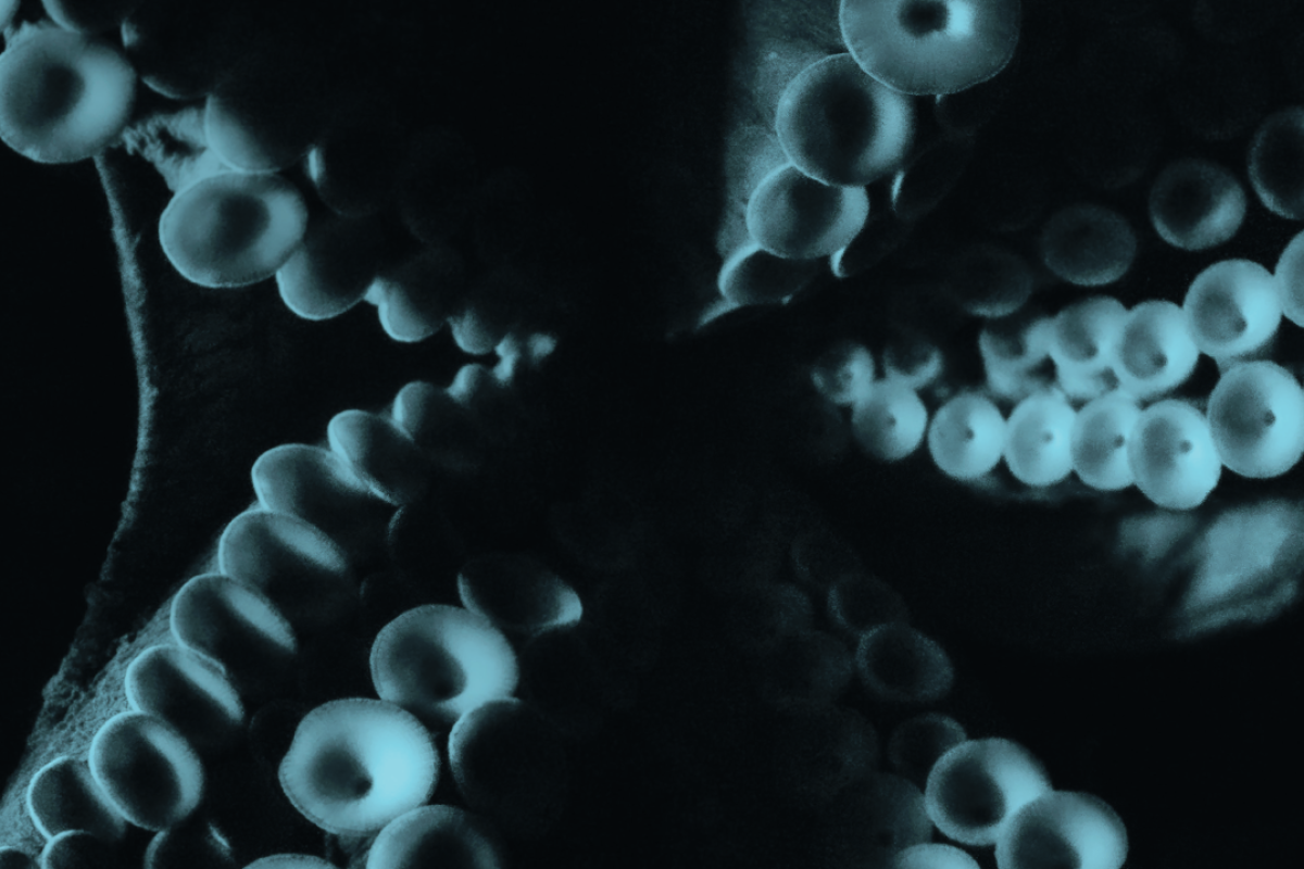 Octopus tentacles with an aqua colored filter