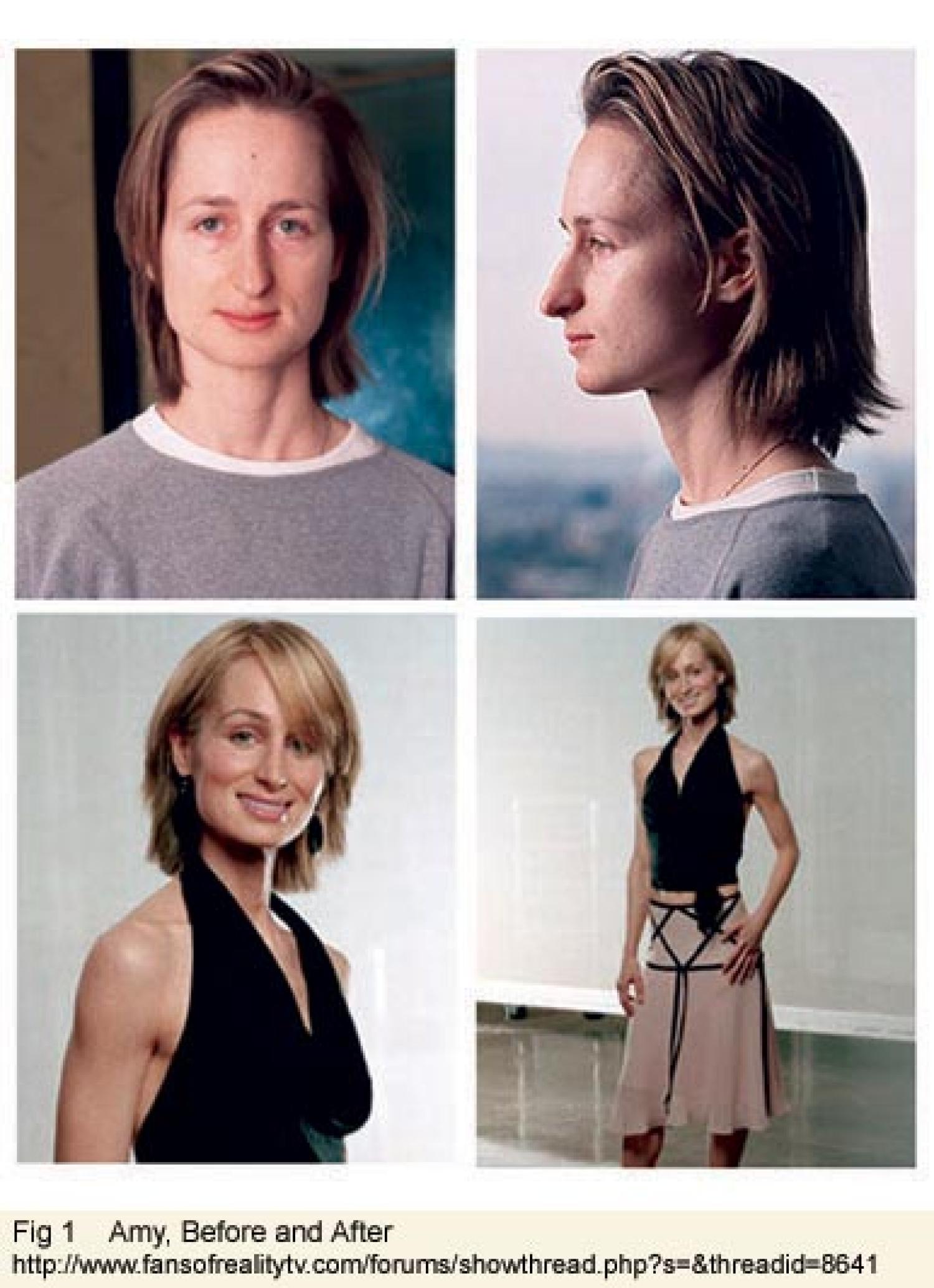 Figure 1: Amy, before and after - Woman's extreme makeover transformation