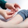 Acupuncture