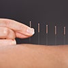 Acupuncture needles