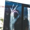 X-ray of hand