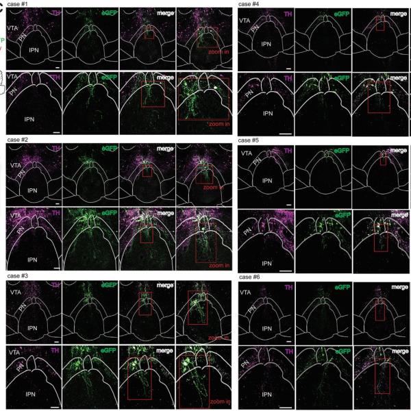 VTADA neurons from the PN send projections to the IPN